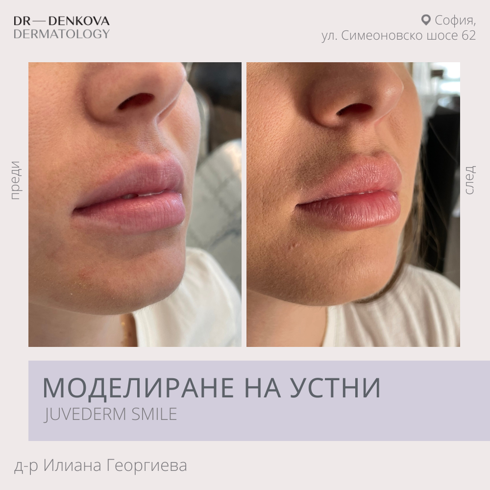 Естетични процедури за лице и тяло – 47 тема | Козметични и естетични ...